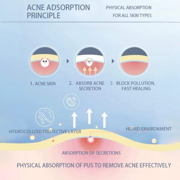 Best Hugrose Acne Patch 216 - Image 3