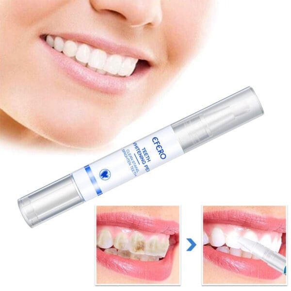 Teeth Whitening Pen - Removes Plaque & Stains, Cleans Teeth, Improves Oral Hygiene. - Image 6