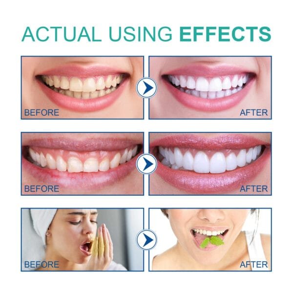 Coconut Oil Mouthwash,Eliminates odor, stains, and freshens breath for effective oral care. - Image 2