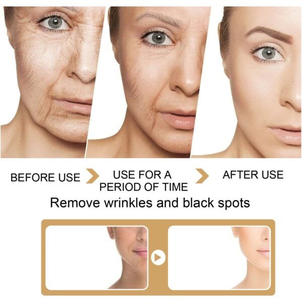 EELHOE Turmeric Dark Spot Correction Face Care Spot Moisturizing - Image 3