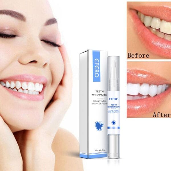 Teeth Whitening Pen - Removes Plaque & Stains, Cleans Teeth, Improves Oral Hygiene. - Image 3