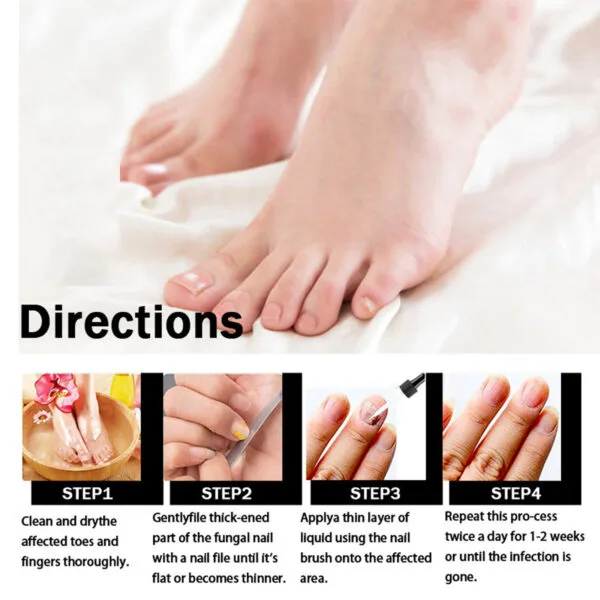 EELHOE Nail Repair Liquid - Image 4