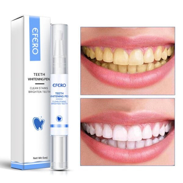 Teeth Whitening Pen - Removes Plaque & Stains, Cleans Teeth, Improves Oral Hygiene. - Image 2