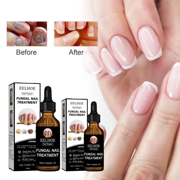 EELHOE Nail Repair Liquid - Image 2