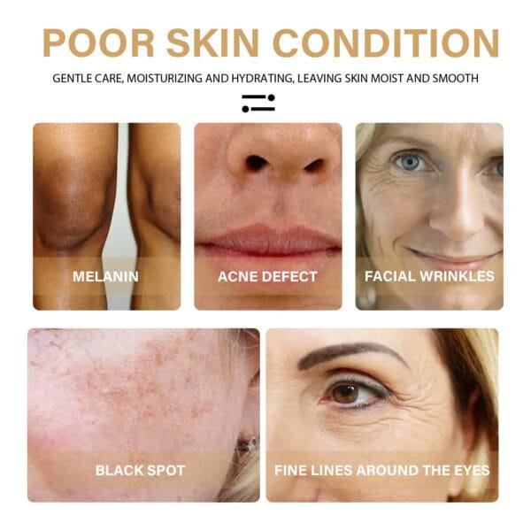 EELHOE Turmeric Dark Spot Correction Face Care Spot Moisturizing - Image 6