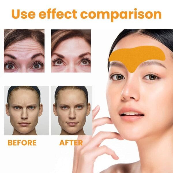 EELHOE Forehead Wrinkle Patch - Image 9