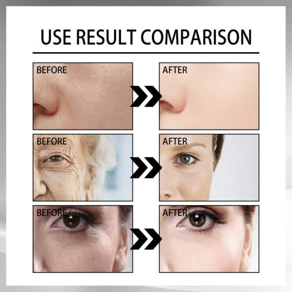 The Best Snail Cream for Wrinkles, Firming & Anti-Aging 100g - Image 4