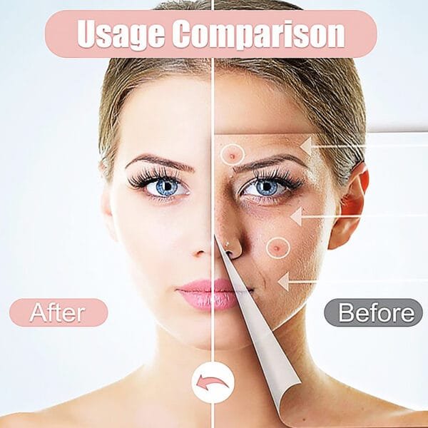 Best Hugrose Acne Patch 216 - Image 7