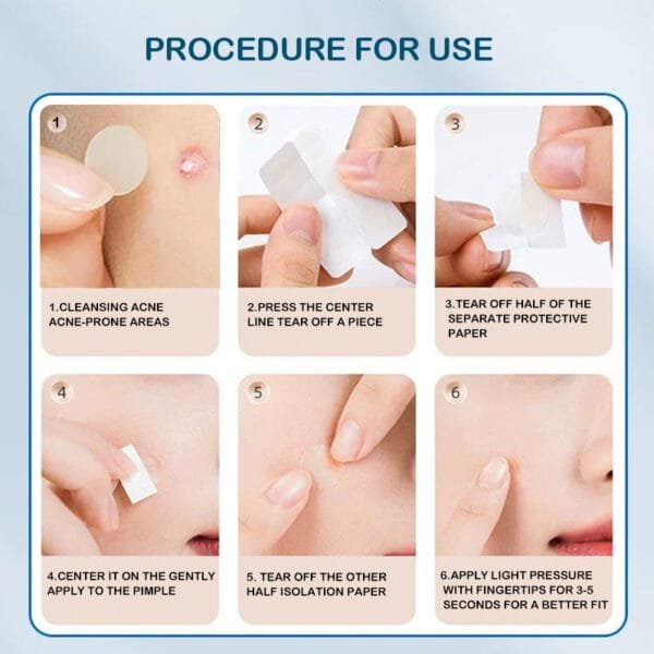Best Hugrose Acne Patch 216 - Image 2